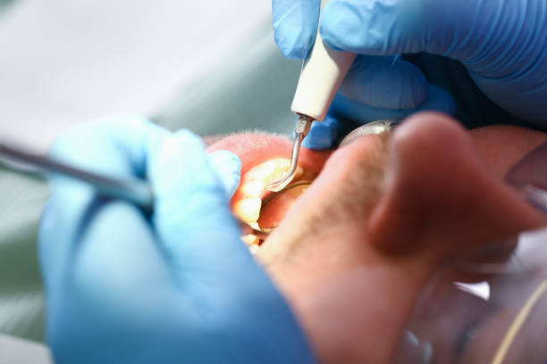 Best Emergency Treatment for Toothache in Mazomanie, WI
