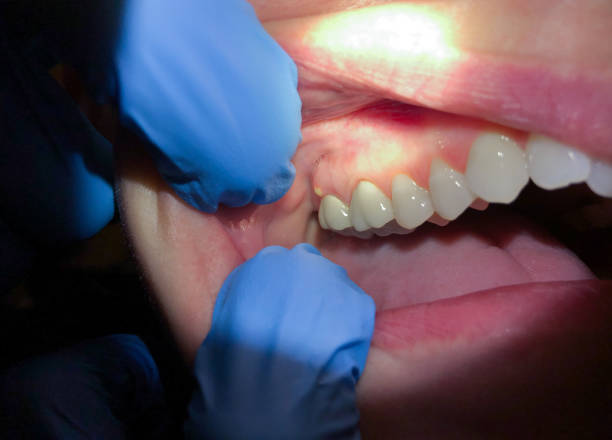 Best Walk-In Emergency Dentist in Mazomanie, WI